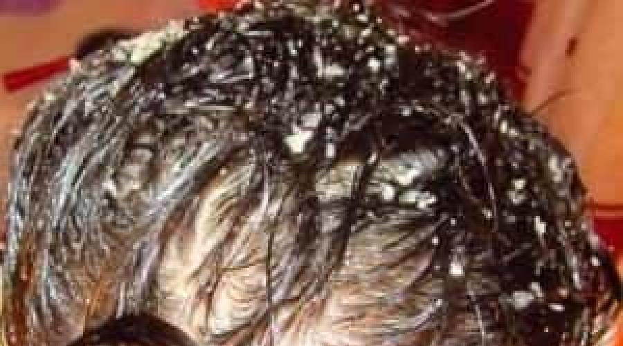Методы лечения и обзор причин сухой себореи кожи головы. Дегтярное мыло сухая себорея Дегтярное мыло от себорейного дерматита