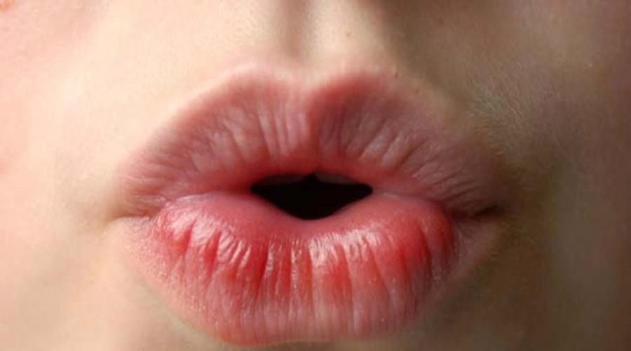 Увеличить губы гимнастикой для лица. Можно ли и как увеличить губы в домашних условиях навсегда? Правила ухода за губами для увеличения их объема
