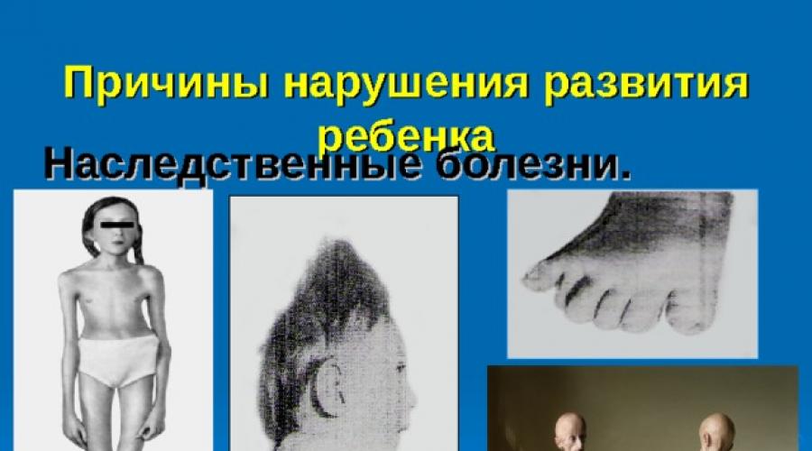 Cauzele dezvoltării afectate a prezentării copiilor Lubovsky.  Prezentare pe tema: Clasificarea tipurilor de tulburări de dezvoltare mentală.  Diagnosticare după pedigree