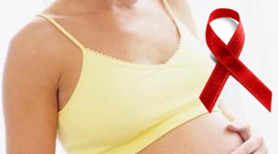 Infecția cu HIV la nou-născuți.  Totul despre HIV la copii - mecanisme de transmitere, simptome și tratament HIV la un copil de 1 an simptome