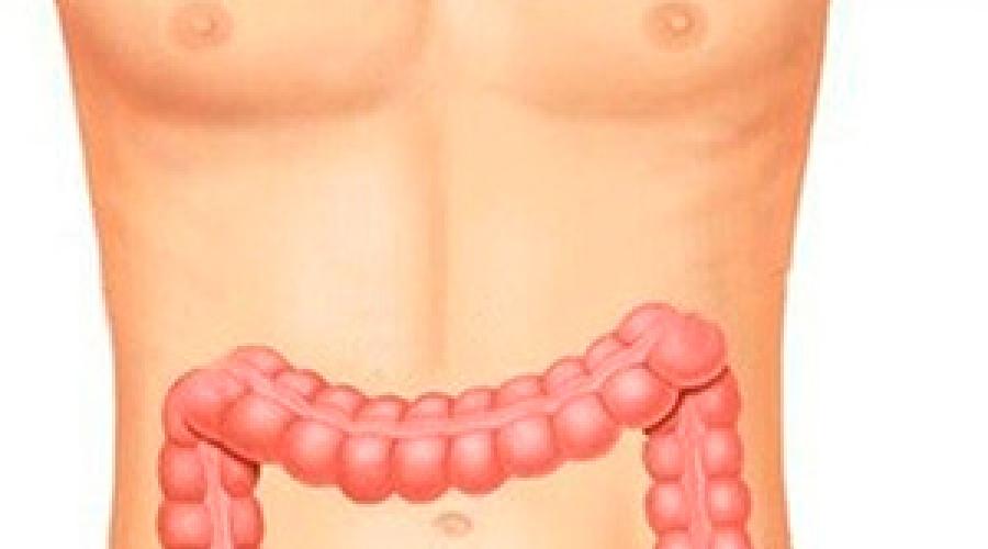 Deteriorarea intestinului.  Ruptură de colon, simptome și tratament.  Aderențe abdominale